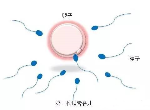 靠谱志愿者供卵咨询